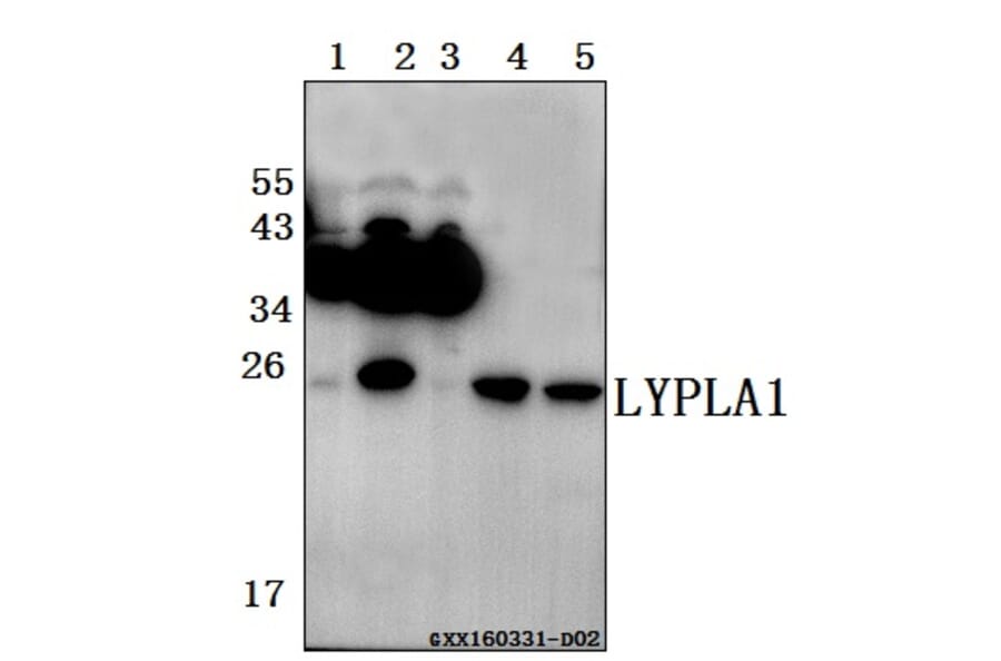Anti-LYPLA1 (K90) Antibody from Bioworld Technology (BS3063) - Antibodies.com