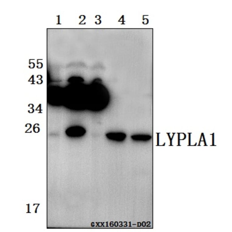 Anti-LYPLA1 (K90) Antibody from Bioworld Technology (BS3063) - Antibodies.com