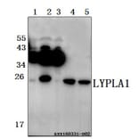 Anti-LYPLA1 (K90) Antibody from Bioworld Technology (BS3063) - Antibodies.com