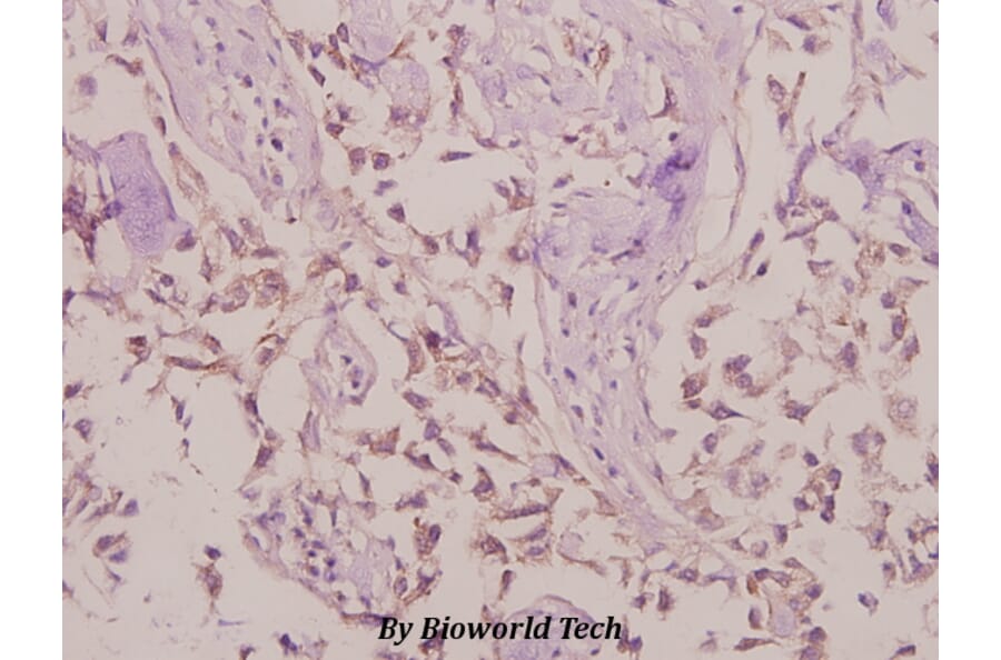 Anti-LYPLA1 (K90) Antibody from Bioworld Technology (BS3063) - Antibodies.com