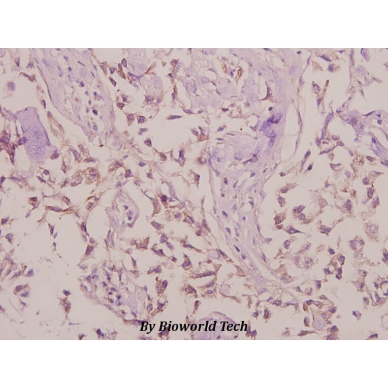 Anti-LYPLA1 (K90) Antibody from Bioworld Technology (BS3063) - Antibodies.com