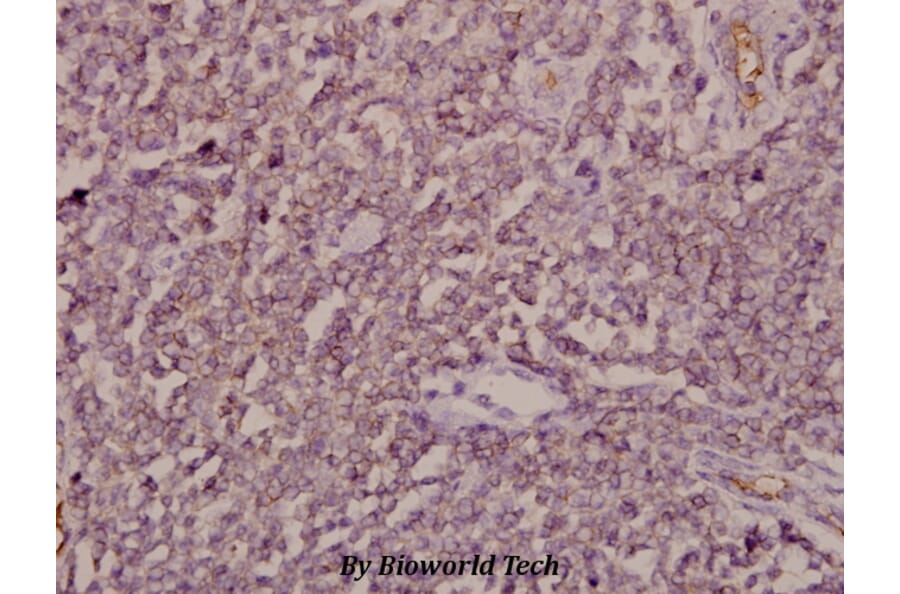 Anti-ARF4 (E106) Antibody from Bioworld Technology (BS3065) - Antibodies.com
