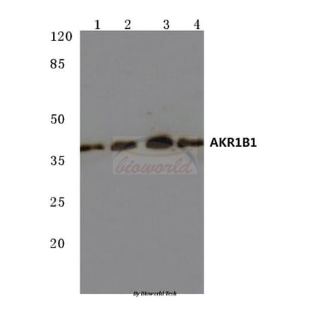 Anti-AKR1B1 (K275) Antibody from Bioworld Technology (BS3067) - Antibodies.com