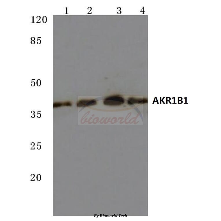 Anti-AKR1B1 (K275) Antibody from Bioworld Technology (BS3067) - Antibodies.com