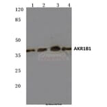 Anti-AKR1B1 (K275) Antibody from Bioworld Technology (BS3067) - Antibodies.com