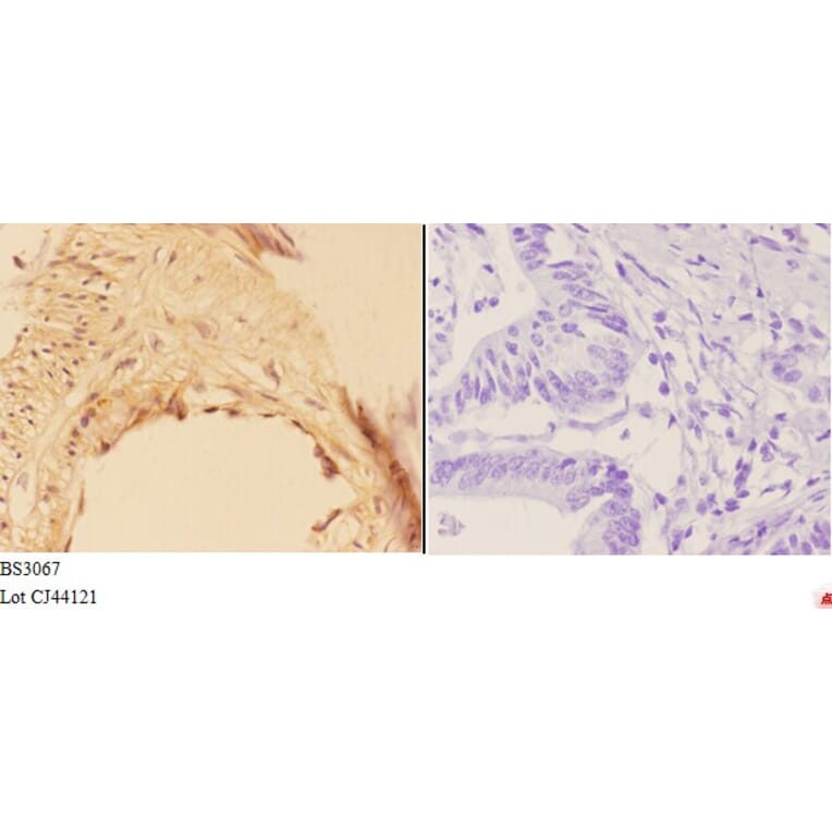 Anti-AKR1B1 (K275) Antibody from Bioworld Technology (BS3067) - Antibodies.com