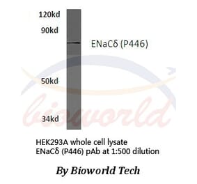 Anti-ENaCδ (P446) Antibody from Bioworld Technology (BS3070) - Antibodies.com