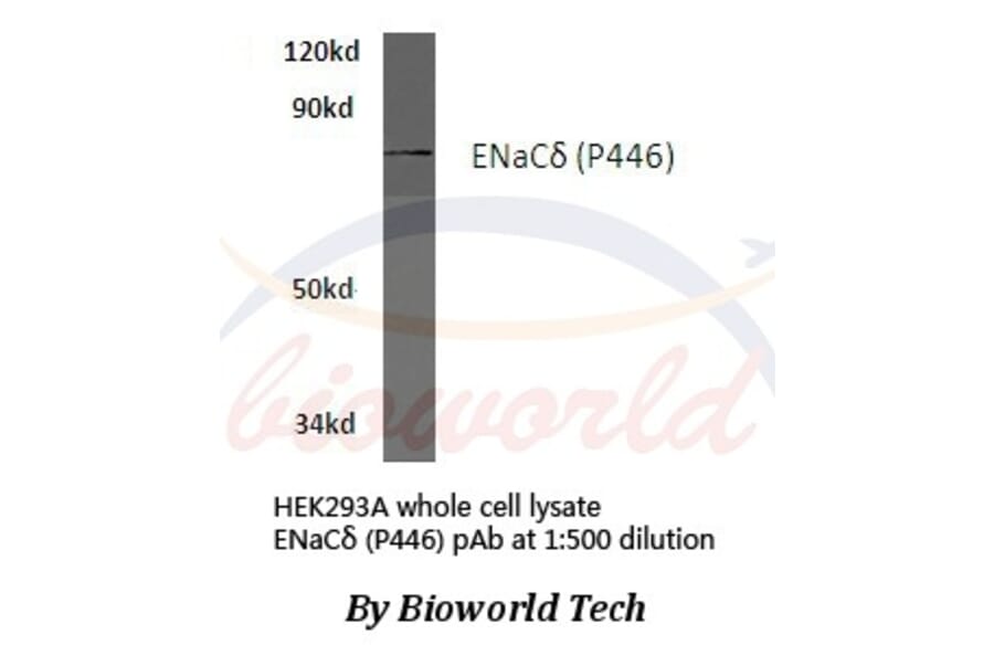 Anti-ENaCδ (P446) Antibody from Bioworld Technology (BS3070) - Antibodies.com