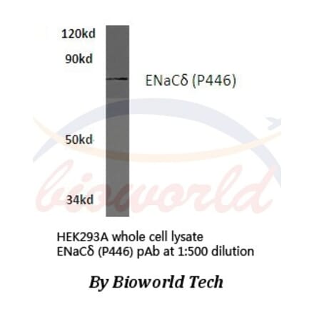 Anti-ENaCδ (P446) Antibody from Bioworld Technology (BS3070) - Antibodies.com