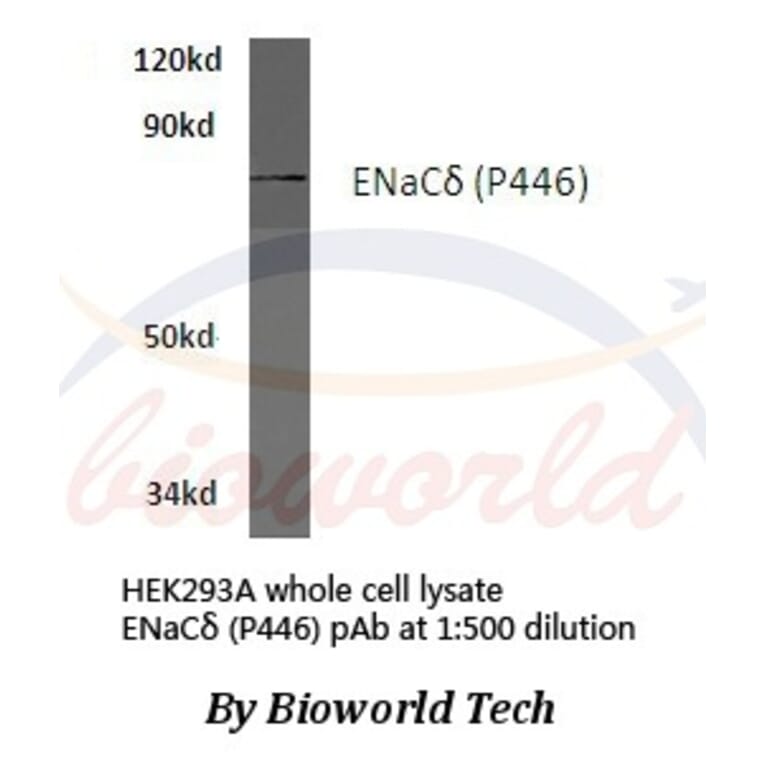 Anti-ENaCδ (P446) Antibody from Bioworld Technology (BS3070) - Antibodies.com
