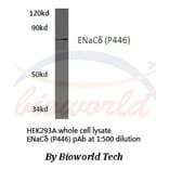 Anti-ENaCδ (P446) Antibody from Bioworld Technology (BS3070) - Antibodies.com