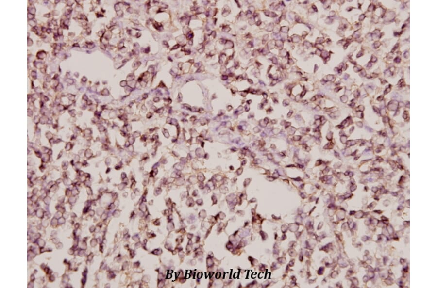 Anti-Arfaptin 1 (K314) Antibody from Bioworld Technology (BS3076) - Antibodies.com