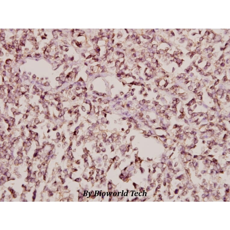 Anti-Arfaptin 1 (K314) Antibody from Bioworld Technology (BS3076) - Antibodies.com