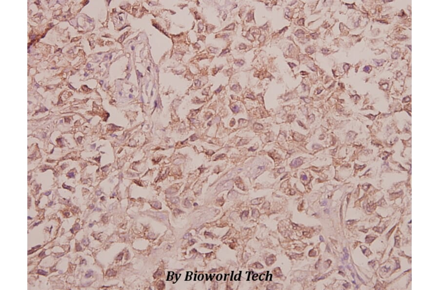 Anti-Arylsulfatase F (Y341) Antibody from Bioworld Technology (BS3078) - Antibodies.com