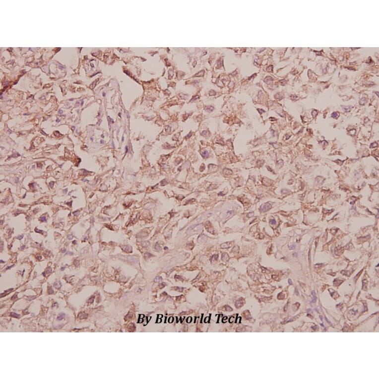 Anti-Arylsulfatase F (Y341) Antibody from Bioworld Technology (BS3078) - Antibodies.com