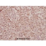 Anti-Arylsulfatase F (Y341) Antibody from Bioworld Technology (BS3078) - Antibodies.com