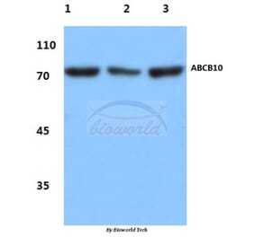 Anti-ABCB10 (E479) Antibody from Bioworld Technology (BS3083) - Antibodies.com