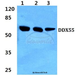 Anti-DDX55 (Q133) Antibody from Bioworld Technology (BS3084) - Antibodies.com