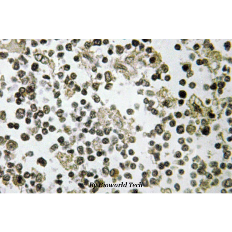 Anti-DDX55 (Q133) Antibody from Bioworld Technology (BS3084) - Antibodies.com