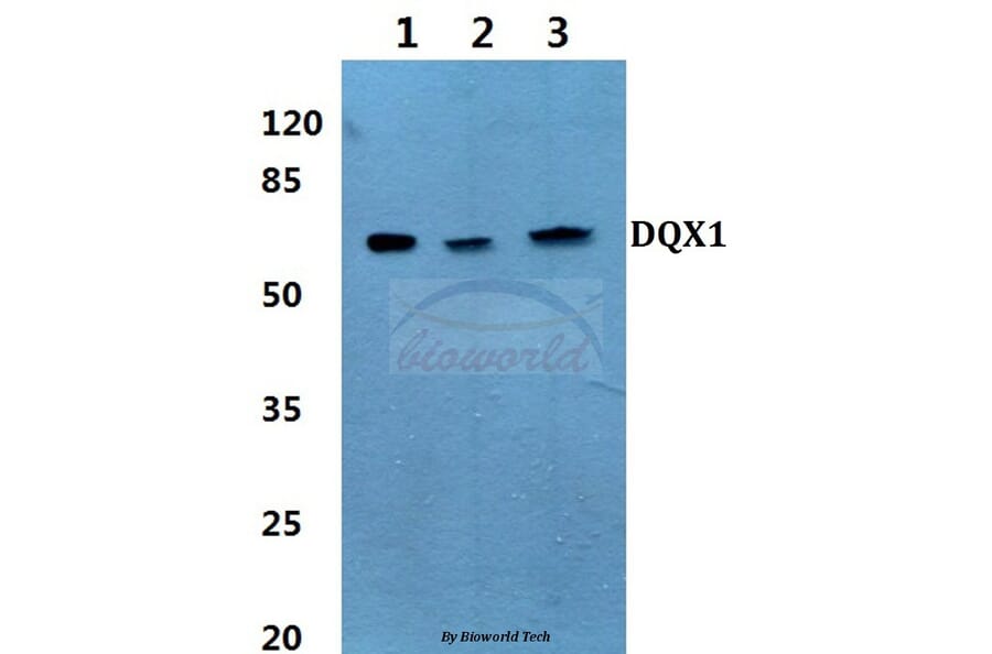 Anti-DQX1 (L595) Antibody from Bioworld Technology (BS3085) - Antibodies.com