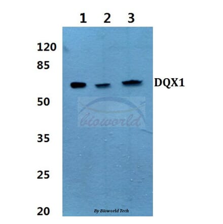 Anti-DQX1 (L595) Antibody from Bioworld Technology (BS3085) - Antibodies.com