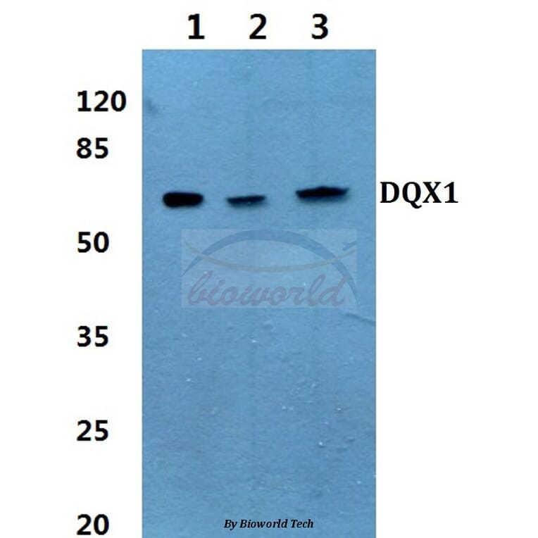 Anti-DQX1 (L595) Antibody from Bioworld Technology (BS3085) - Antibodies.com