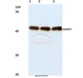 Anti-GCNT7 (N349) Antibody from Bioworld Technology (BS3088) - Antibodies.com