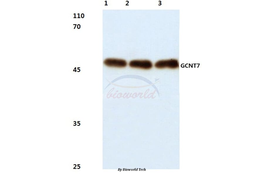 Anti-GCNT7 (N349) Antibody from Bioworld Technology (BS3088) - Antibodies.com