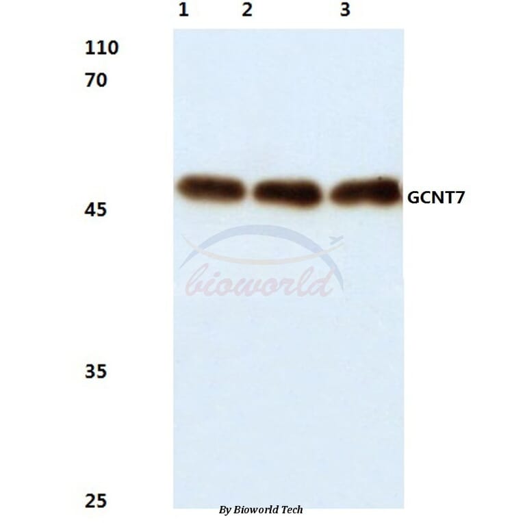 Anti-GCNT7 (N349) Antibody from Bioworld Technology (BS3088) - Antibodies.com