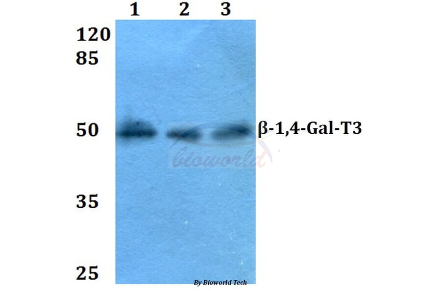 Anti-β-1,4-Gal-T3 (F304) Antibody from Bioworld Technology (BS3090) - Antibodies.com