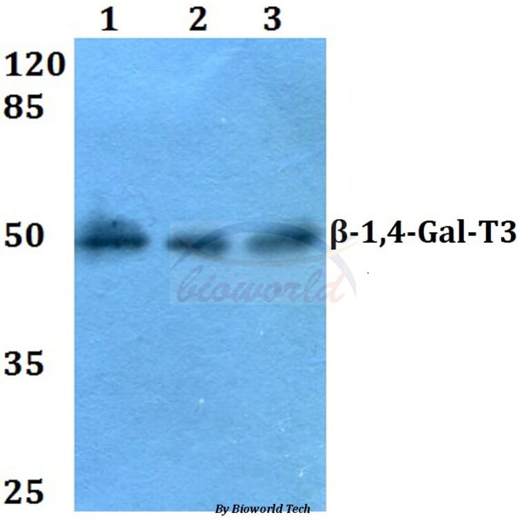 Anti-β-1,4-Gal-T3 (F304) Antibody from Bioworld Technology (BS3090) - Antibodies.com