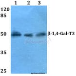 Anti-β-1,4-Gal-T3 (F304) Antibody from Bioworld Technology (BS3090) - Antibodies.com