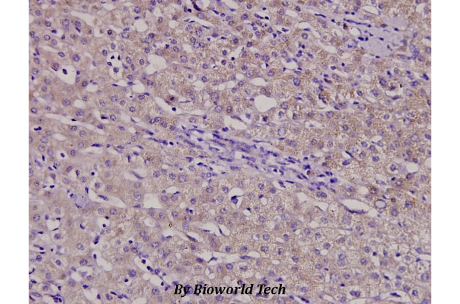 Anti-β-1,4-Gal-T3 (F304) Antibody from Bioworld Technology (BS3090) - Antibodies.com