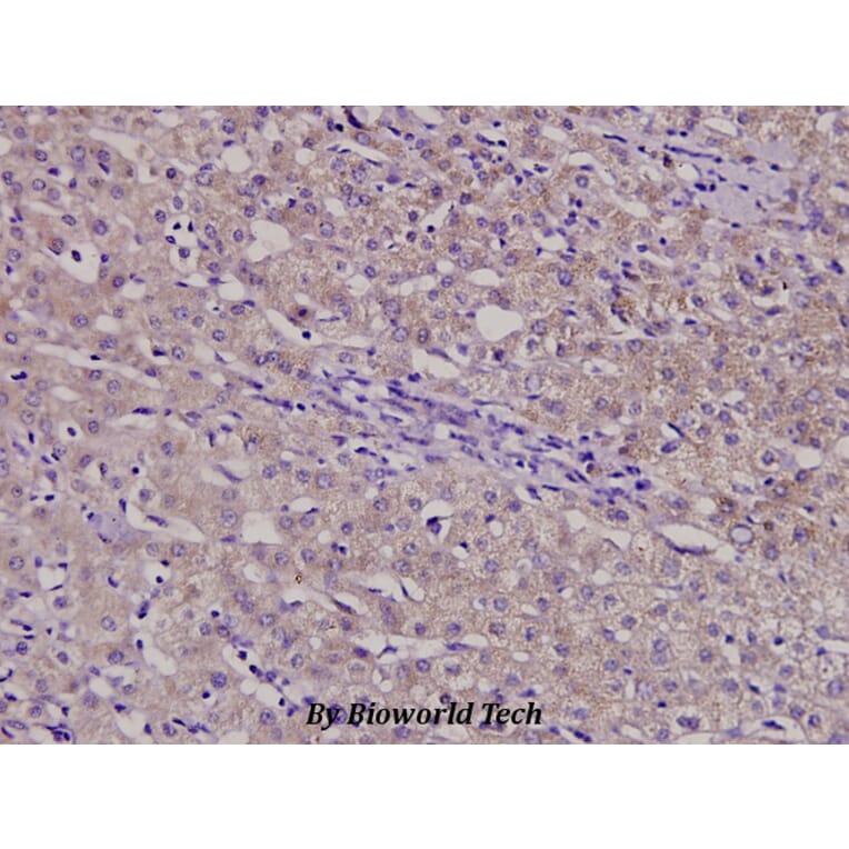 Anti-β-1,4-Gal-T3 (F304) Antibody from Bioworld Technology (BS3090) - Antibodies.com