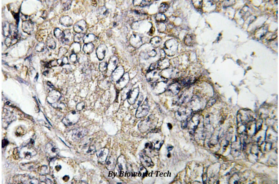 Anti-BIG2 (L1527) Antibody from Bioworld Technology (BS3095) - Antibodies.com