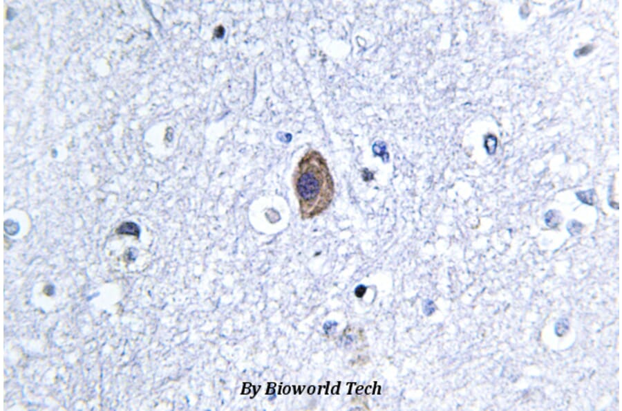 Anti-Calponin 2 (D156) Antibody from Bioworld Technology (BS3097) - Antibodies.com