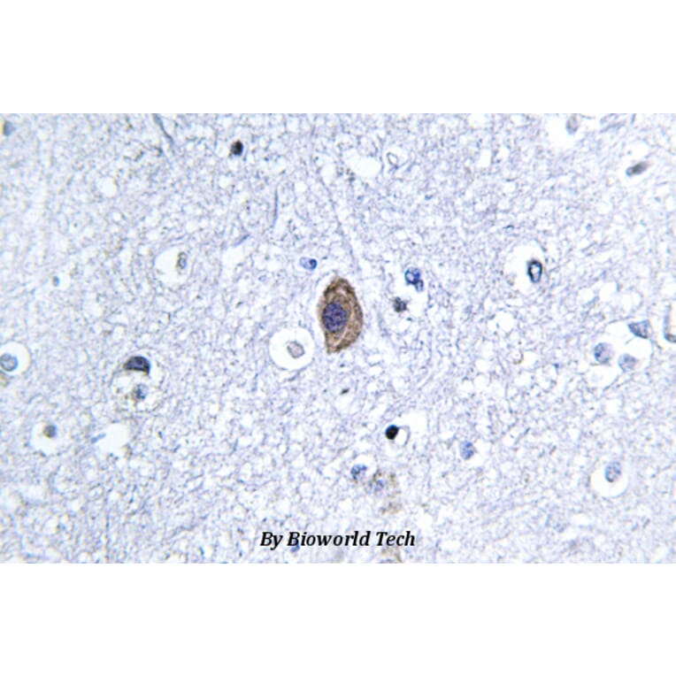 Anti-Calponin 2 (D156) Antibody from Bioworld Technology (BS3097) - Antibodies.com