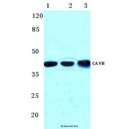 Anti-CA VB (N280) Antibody from Bioworld Technology (BS3098) - Antibodies.com