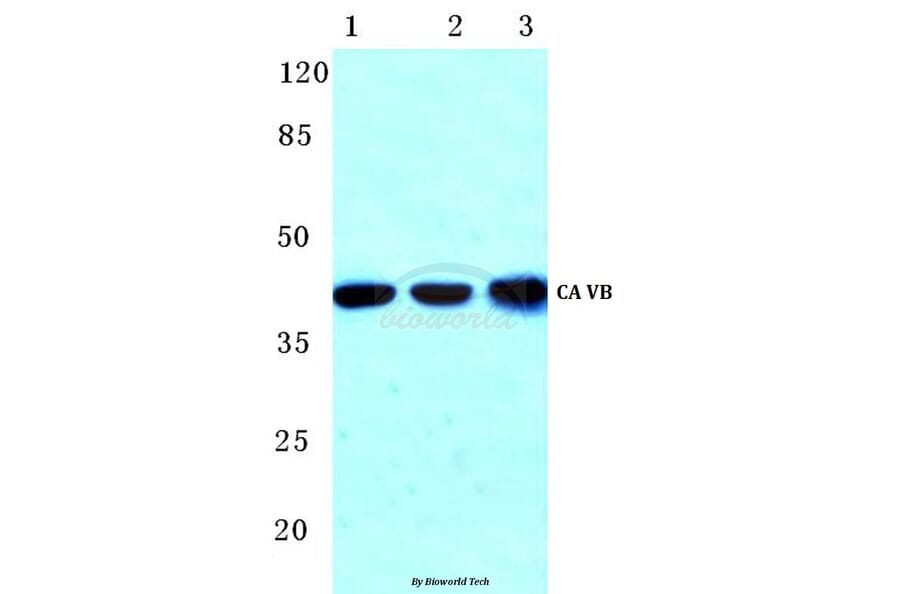 Anti-CA VB (N280) Antibody from Bioworld Technology (BS3098) - Antibodies.com
