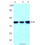 Anti-CA VB (N280) Antibody from Bioworld Technology (BS3098) - Antibodies.com