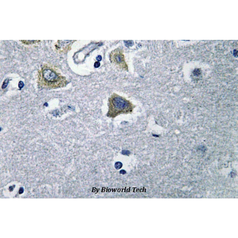 Anti-CA VB (N280) Antibody from Bioworld Technology (BS3098) - Antibodies.com