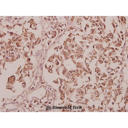 Anti-CEP135 (H1117) Antibody from Bioworld Technology (BS3100) - Antibodies.com