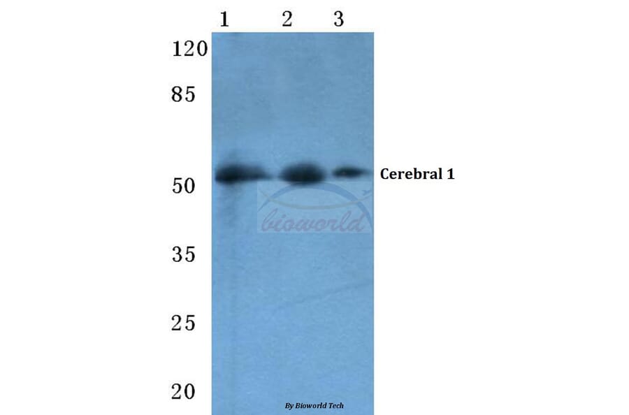 Anti-Cerebral 1 (L310) Antibody from Bioworld Technology (BS3101) - Antibodies.com