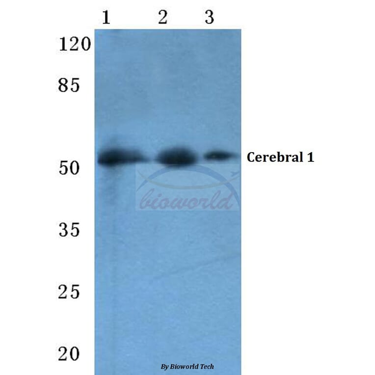 Anti-Cerebral 1 (L310) Antibody from Bioworld Technology (BS3101) - Antibodies.com