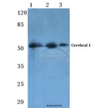 Anti-Cerebral 1 (L310) Antibody from Bioworld Technology (BS3101) - Antibodies.com