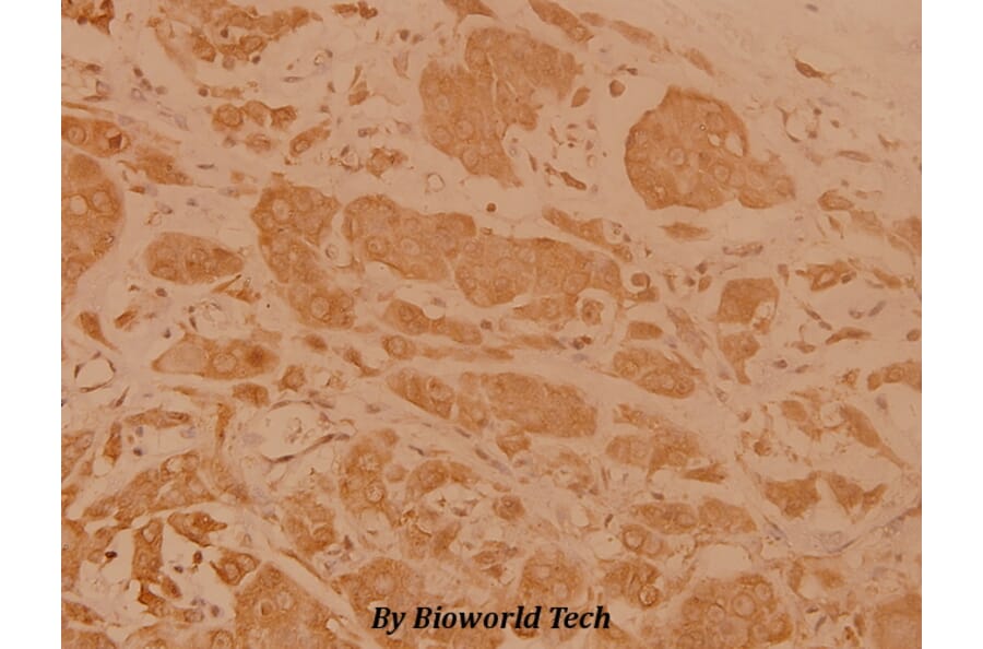 Anti-Cerebral 1 (L310) Antibody from Bioworld Technology (BS3101) - Antibodies.com