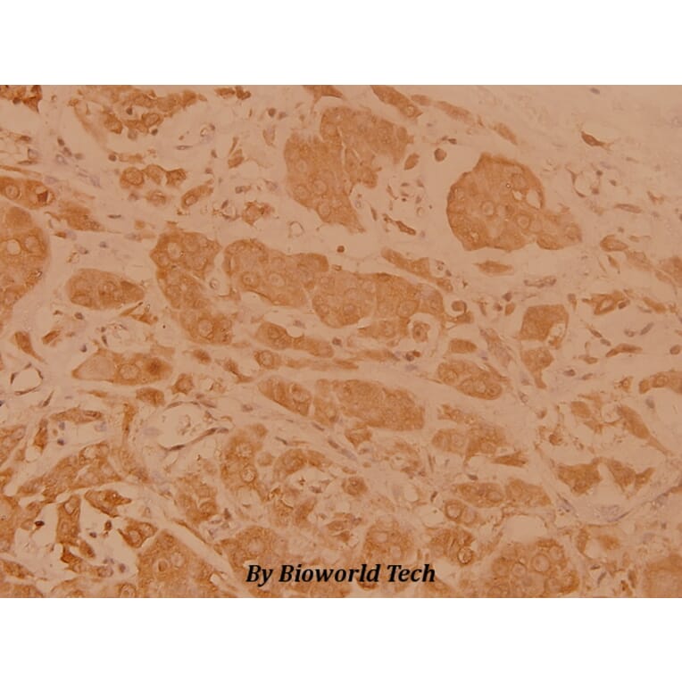 Anti-Cerebral 1 (L310) Antibody from Bioworld Technology (BS3101) - Antibodies.com