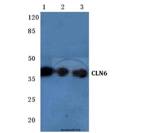 Anti-CLN6 (N258) Antibody from Bioworld Technology (BS3102) - Antibodies.com