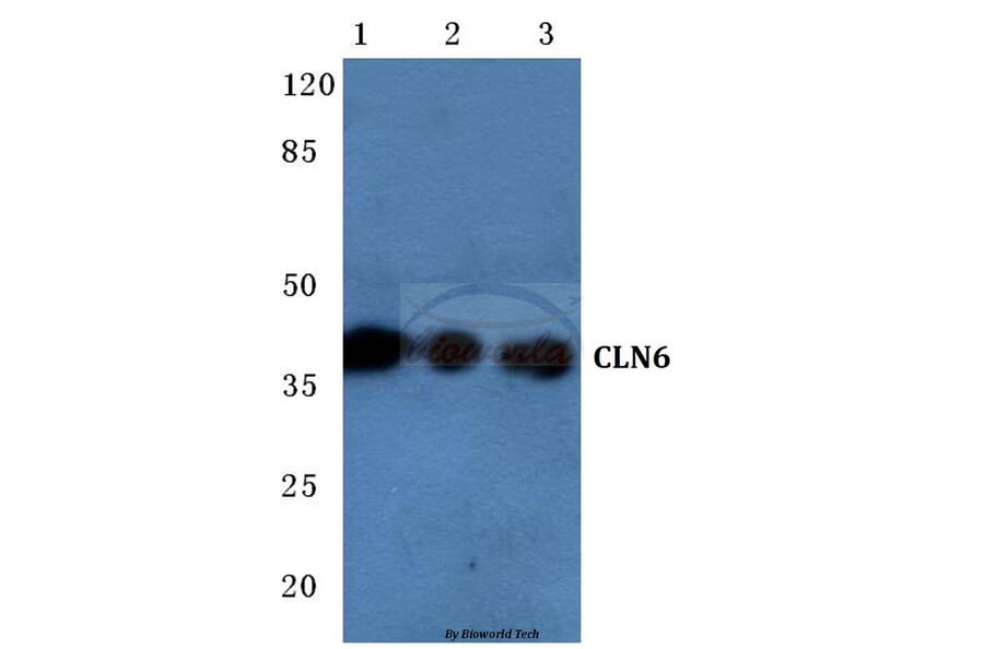 Anti-CLN6 (N258) Antibody from Bioworld Technology (BS3102) - Antibodies.com