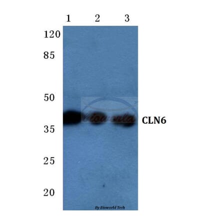 Anti-CLN6 (N258) Antibody from Bioworld Technology (BS3102) - Antibodies.com